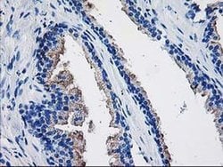 TBC1D21 Monoclonal Antibody (OTI6F9), TrueMAB , OriGene 100 &mu;L; Unconjugated:Antibodies,