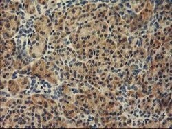 TBC1D21 Monoclonal Antibody (OTI1C7), TrueMAB , OriGene 100 &mu;L; Unconjugated:Antibodies,
