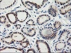 TBC1D21 Monoclonal Antibody (OTI1C7), TrueMAB , OriGene 100 &mu;L; Unconjugated:Antibodies,