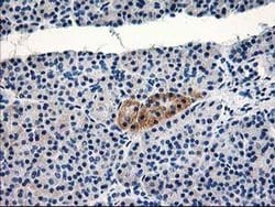 TBC1D21 Monoclonal Antibody (OTI3C2), TrueMAB , OriGene 100 &mu;L; Unconjugated:Antibodies,