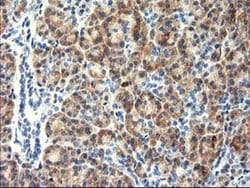 TBC1D21 Monoclonal Antibody (OTI1A8), TrueMAB , OriGene:Antibodies:Primary