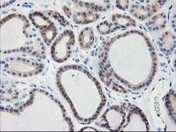 TBC1D21 Monoclonal Antibody (OTI1A8), TrueMAB , OriGene 100 &mu;L; Unconjugated:Antibodies,