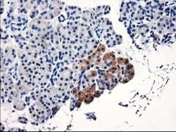TBC1D21 Monoclonal Antibody (OTI7G10), TrueMAB , OriGene 30 &mu;L; Unconjugated:Antibodies,