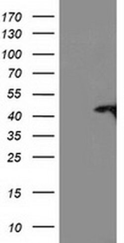 TBC1D21 Monoclonal Antibody (OTI6F9), TrueMAB , OriGene:Antibodies:Primary