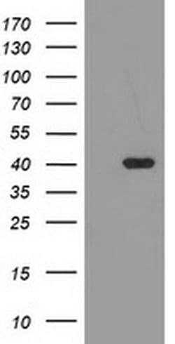 TBC1D21 Monoclonal Antibody (OTI1A8), TrueMAB , OriGene:Antibodies:Primary