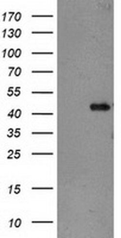 TBC1D21 Monoclonal Antibody (OTI3F1), TrueMAB , OriGene 30 &mu;L; Unconjugated:Antibodies,