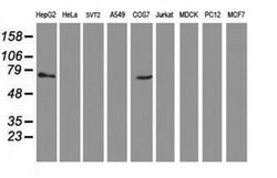 TBC1D21 Monoclonal Antibody (OTI3F1), TrueMAB , OriGene:Antibodies:Primary