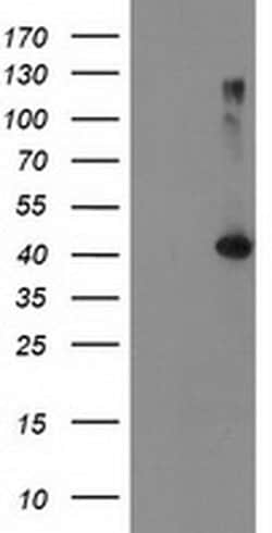 TBC1D21 Monoclonal Antibody (OTI7G10), TrueMAB , OriGene 30 &mu;L; Unconjugated:Antibodies,