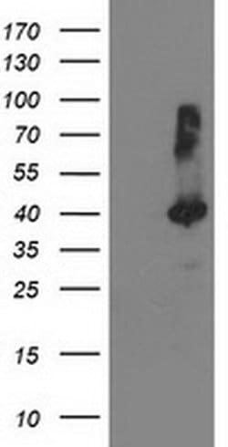 TBC1D21 Monoclonal Antibody (OTI8C1), TrueMAB , OriGene 30 &mu;L; Unconjugated:Antibodies,