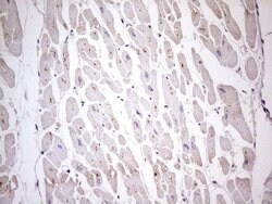 TBC1D28 Monoclonal Antibody (OTI4A9), TrueMAB , OriGene 100 &mu;L; Unconjugated:Antibodies,