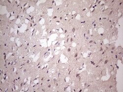 TBC1D28 Monoclonal Antibody (OTI4A9), TrueMAB , OriGene 100 &mu;L; Unconjugated:Antibodies,