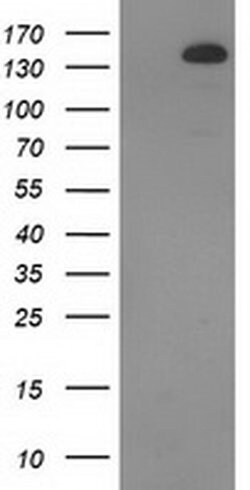 TBC1D4 Monoclonal Antibody (OTI5E6), TrueMAB , OriGene 30 &mu;L | Buy Online | OriGene | Fisher Scientific