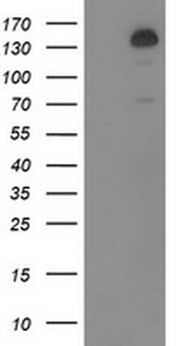 TBC1D4 Monoclonal Antibody (OTI5A6), TrueMAB , OriGene 30 &mu;L; Unconjugated:Antibodies,