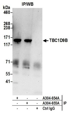 TBC1D9B Rabbit anti-Human, Polyclonal, Bethyl Laboratories 10 &mu;L; Unconjugated:Antibodies,