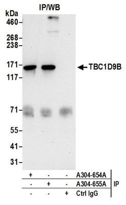 TBC1D9B Rabbit anti-Human, Polyclonal, Bethyl Laboratories 100 &mu;L | Buy Online | Bethyl Laboratories, Inc | Fisher Scientific