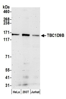 TBC1D9B Rabbit anti-Human, Polyclonal, Bethyl Laboratories 100 &mu;L | Buy Online | Bethyl Laboratories, Inc | Fisher Scientific