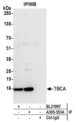 TBCA Rabbit anti-Human, Polyclonal, Bethyl Laboratories 100 &mu;L; Unconjugated:Antibodies,