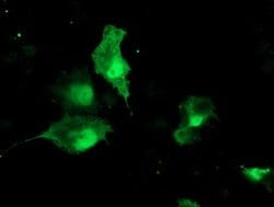 TBCC Monoclonal Antibody (OTI4C4), TrueMAB , OriGene 100 &mu;L; Unconjugated:Antibodies,