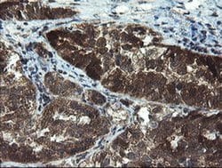 TBCC Monoclonal Antibody (OTI4C4), TrueMAB , OriGene 100 &mu;L; Unconjugated:Antibodies,