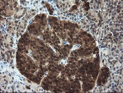 TBCC Monoclonal Antibody (OTI4C4), TrueMAB , OriGene 100 &mu;L; Unconjugated:Antibodies,
