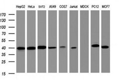 TBCC Monoclonal Antibody (OTI1B2), TrueMAB , OriGene 100 &mu;L; Unconjugated:Antibodies,