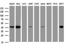 TBCC Monoclonal Antibody (OTI1F2), TrueMAB , OriGene 30 &mu;L; Unconjugated:Antibodies,