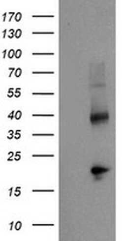 TBCC Monoclonal Antibody (OTI2B3), TrueMAB , OriGene 100 &mu;L; Unconjugated:Antibodies,