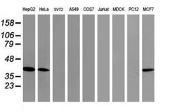 TBCC Monoclonal Antibody (OTI2B3), TrueMAB , OriGene 100 &mu;L; Unconjugated:Antibodies,