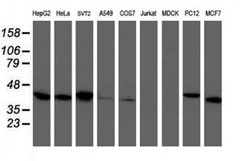 TBCC Monoclonal Antibody (OTI4C4), TrueMAB , OriGene 100 &mu;L; Unconjugated:Antibodies,