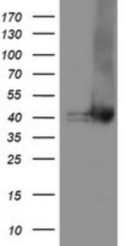 TBCC Mouse anti-Human, Clone: OTI2D1, lyophilized, TrueMAB 100 &mu;g | Buy Online | Origene Technologies | Fisher Scientific