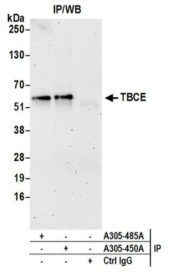 TBCE Rabbit anti-Human, Polyclonal, Bethyl Laboratories 100 &mu;L; Unconjugated:Antibodies,