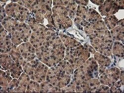 TBCEL Monoclonal Antibody (OTI2A9), TrueMAB , OriGene 30 &mu;L; Unconjugated:Antibodies,