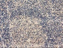 TBCEL Monoclonal Antibody (OTI2A9), TrueMAB , OriGene 30 &mu;L; Unconjugated:Antibodies,