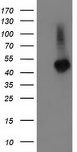 TBCEL Monoclonal Antibody (OTI3H3), TrueMAB , OriGene 30 &mu;L | Buy Online | Origene Technologies | Fisher Scientific