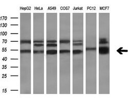 TBCEL Monoclonal Antibody (OTI2A9), TrueMAB , OriGene 30 &mu;L; Unconjugated:Antibodies,