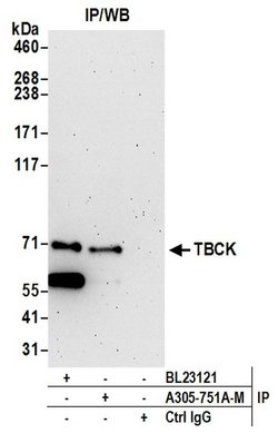 TBCK Polyclonal Antibody, Bethyl Laboratories:Antibodies:Primary Antibodies