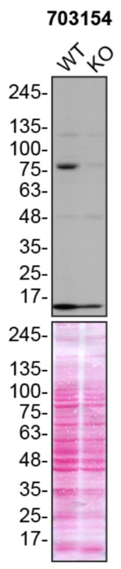 Invitrogen TBK1 Recombinant Rabbit Monoclonal Antibody (12H60L39) 100 &mu;g;