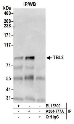 TBL3 Rabbit anti-Human, Polyclonal, Bethyl Laboratories 100 &mu;L; Unconjugated:Antibodies,