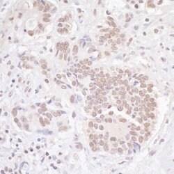 TBLR1 Rabbit anti-Human, Mouse, Polyclonal, Bethyl Laboratories 100 &mu;L;