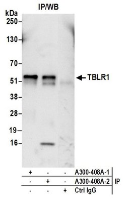TBLR1 Rabbit anti-Human, Mouse, Polyclonal, Bethyl Laboratories 100 &mu;L;