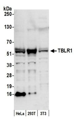 TBLR1 Rabbit anti-Human, Mouse, Polyclonal, Bethyl Laboratories 100 &mu;L;