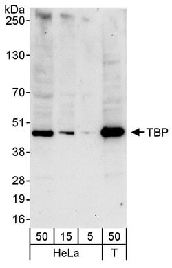 TBP Rabbit anti-Human, Polyclonal, Bethyl Laboratories 10 &mu;L; Unconjugated:Antibodies,