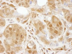 TBP1 Rabbit anti-Human, Mouse, Polyclonal, Bethyl Laboratories 100 &mu;L;