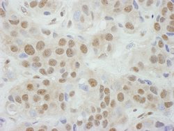 TBP1 Rabbit anti-Human, Mouse, Polyclonal, Bethyl Laboratories 100 &mu;L;