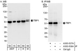 TBP1 Rabbit anti-Human, Mouse, Polyclonal, Bethyl Laboratories 100 &mu;L;