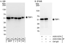 TBP1 Rabbit anti-Human, Mouse, Polyclonal, Bethyl Laboratories 100 &mu;L;