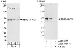 TBRG4/CPR2 Rabbit anti-Human, Polyclonal, Bethyl Laboratories 100 &mu;L;
