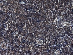 TBX1 Mouse anti-Human, Clone: OTI1C2, lyophilized, TrueMAB 100 &mu;g; Unconjugated:Antibodies,