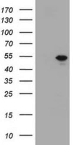 TBX19 (Tpit) Mouse anti-Human, Clone: OTI1C9, lyophilized, TrueMAB 100