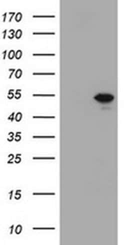 TBX19 (Tpit) Monoclonal Antibody (OTI1C9), TrueMAB , OriGene:Antibodies:Primary